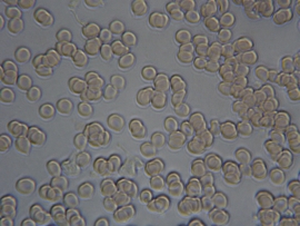 Human red blood cells (haematids, erythrocytes)