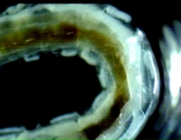 Algae eater worm