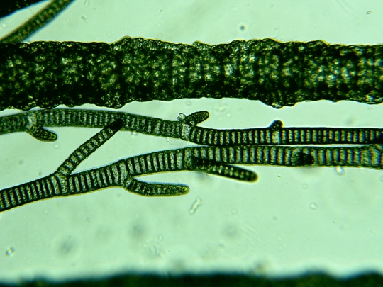 Cyanobacteria (Blue-green bacteria, blue-green algae)
