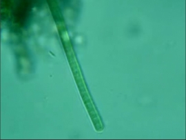 Cyanobacteria (Blue-green bacteria, blue-green algae)