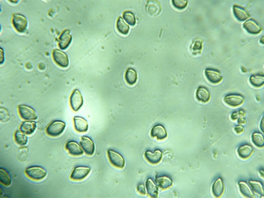 Fish blood cells (Gurami species)