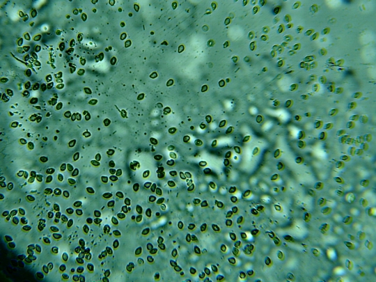 Fish blood cells (Gurami species)