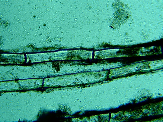 Caudal (tail) fin of a Zebra fish