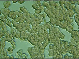 Globule rosii (eritrocite, hematii)