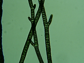Algele verzi-albastre (cianobacterii)