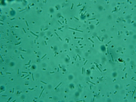 Bacterii din iaurt